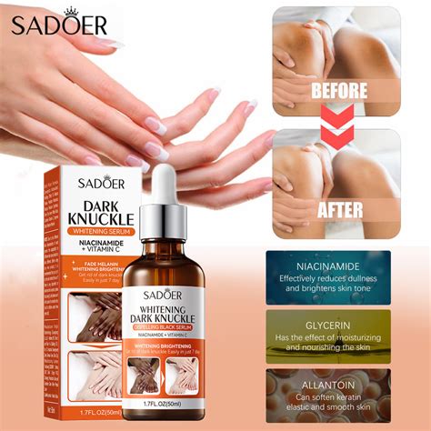 Sadoer Dark Knuckle Whitening Serum Ml Nicotinamide Vitamin C Body