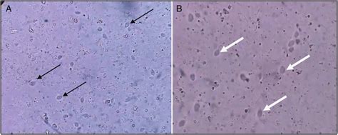 A Black Arrow Trophozoites Of Pentatrichomonas Hominis On Stool Download Scientific Diagram