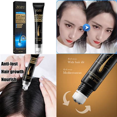 Fast Hair Growth Essence Effective Anti Hair Loss Serum Baldness Repair