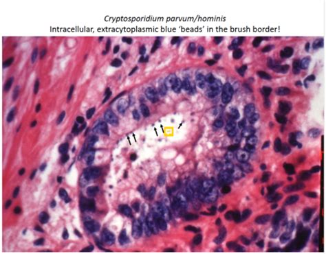 APICOMPLEXANS INTESTINAL COCCIDIA Flashcards Quizlet