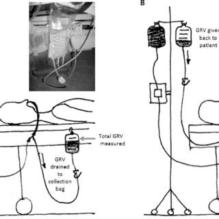 Classic gastric residual volume measurement | Download Scientific Diagram