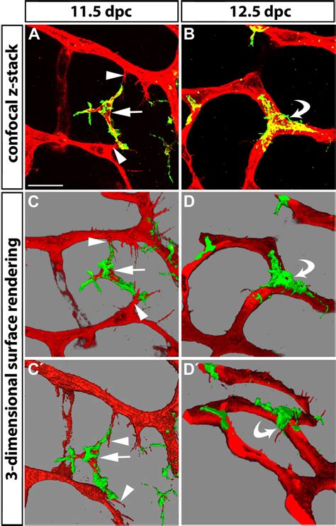 Tissue Macrophages Bridge Endothelial Tip Cells And Are Present At