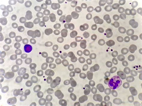 Normal Values And Composition Of Blood Howitreat In