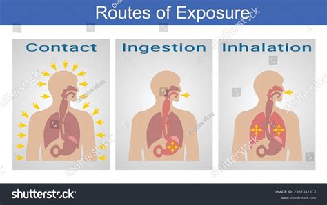 Vector Illustration For Routes Of Exposure Royalty Free Stock Vector