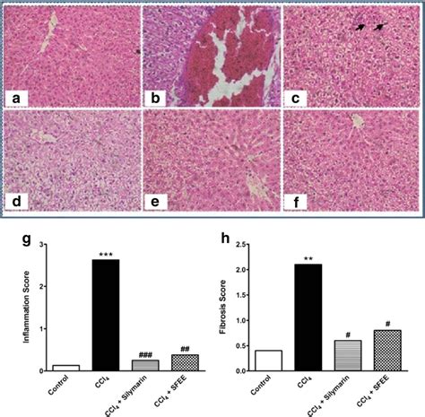 Histological Examination Of Liver Sections From Different Groups Liver