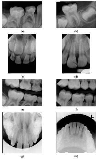 Jpm Free Full Text Radiation Exposure And Frequency Of Dental