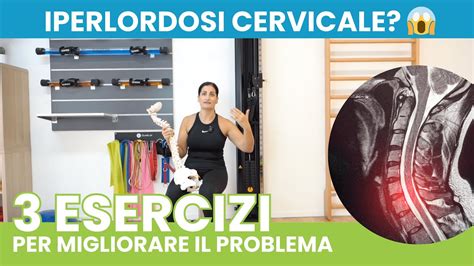 Iperlordosi Cervicale Esercizi Per Migliorare La Tua Condizione