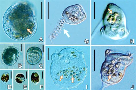 Functional Ecology Of Two Contrasting Freshwater Ciliated Protists In Relation To Temperature