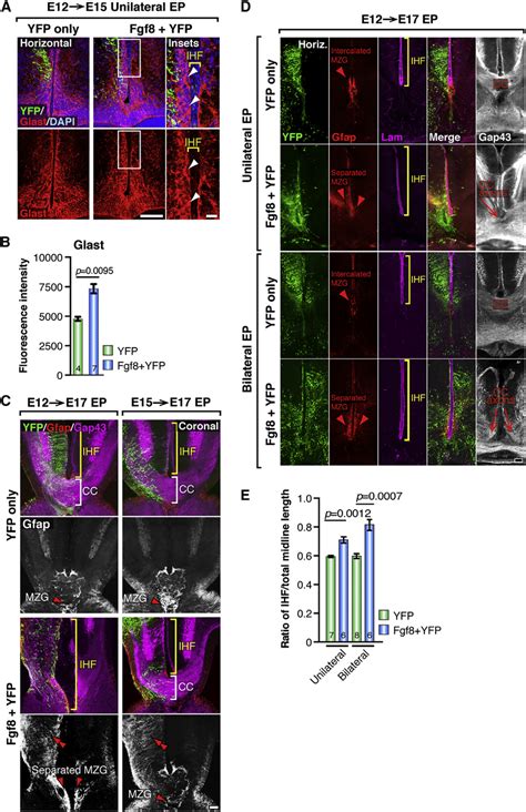 Fgf Signaling Promotes Astroglial Maturation Of The Mzg In Mice A