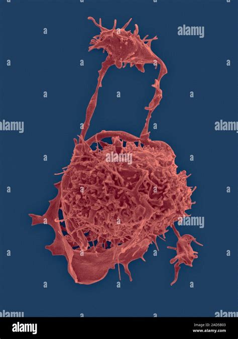 Human Bone Marrow Megakaryocyte And Platelet Formation Coloured