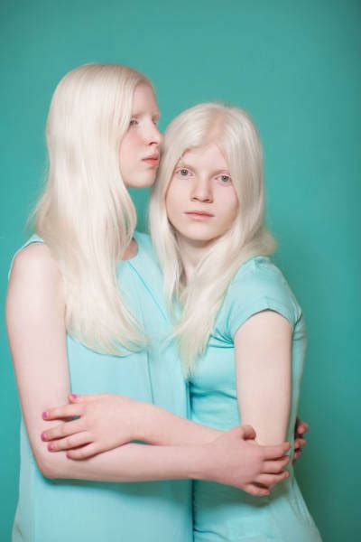 These Beautiful Albino People Are Simply Breathtaking 58 Pics