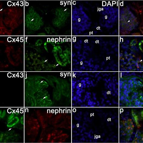 Co Expression Of Synaptopodin And Nephrin With Different Cx In