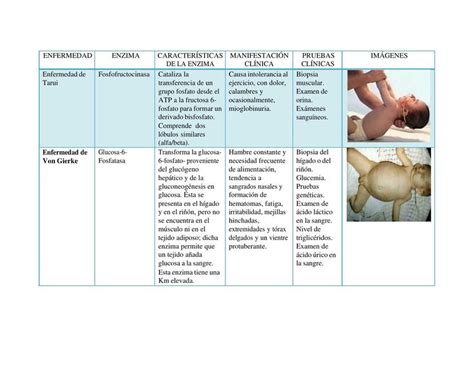 Cuadro Comparativo De Enfermedades De La Glucolisi Daniela UDocz