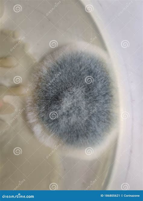 Bacillus Y Aspergillus Fumigatus En Cultivo En Medio De Agar Nutritivo