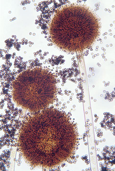 Aspergillus Niger Structure