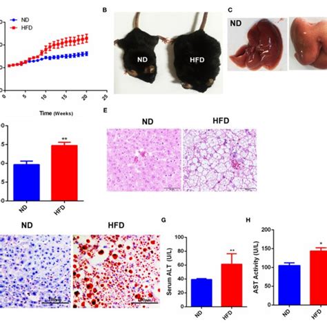 Liver Fatty Injury In Hfd Feeding Mice Activated Hepatic