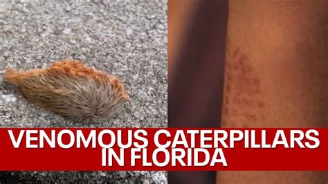 Venomous Puss Caterpillars Spotted In Central Florida Youtube