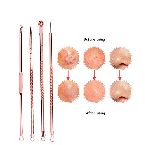 4 pcs/Set Skin Care Beauty Products Acne Blackhead Removal Needles ...