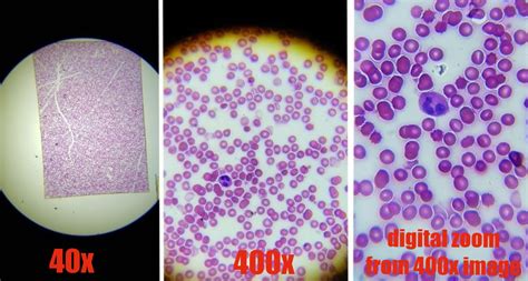 Blood Under Microscope