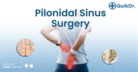 Pilonidal Sinus surgery in Kochi - Book a Appointment | QuikDr.