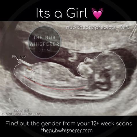 Girly Nub Nub Theory Gender Prediction Ultrasound Gender