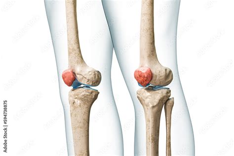 Stock Illustrationen Patella Or Kneecap Bone In Red Color With Body D