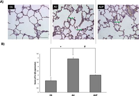 a Representative sections of IL-1β immunohistochemistry. Immunolabeled ...