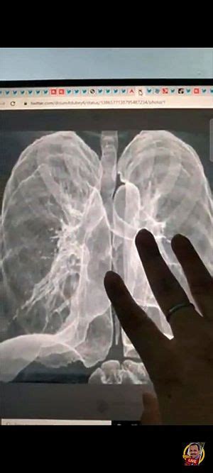 Watch Corona Teenager Hot Teen Threesome Porn Spankbang