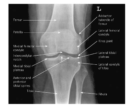 Teknik Pemeriksaan Knee Joint