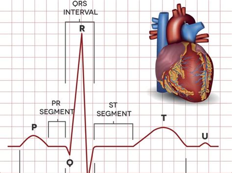 Lectura E Interpretaci N De Electrocardiograma Salud Capacitaciones