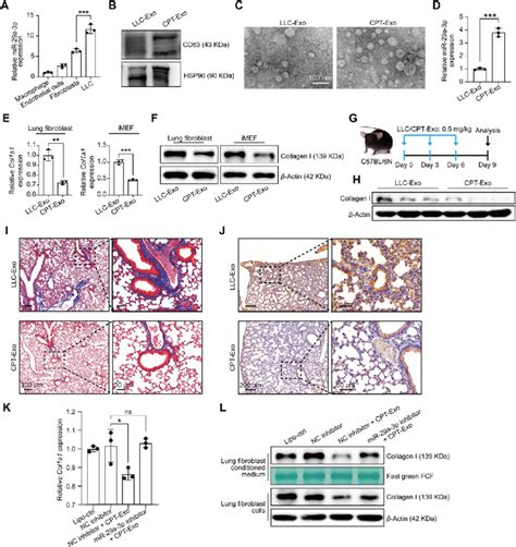 MiR 29a 3p Loading Into CPT Exo Down Regulated Collagen I Expression In