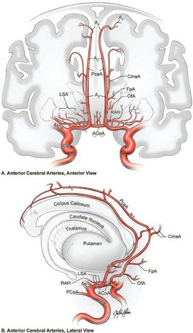 Anterior Communicating Artery Aneurysms | Neupsy Key | Basic anatomy ...