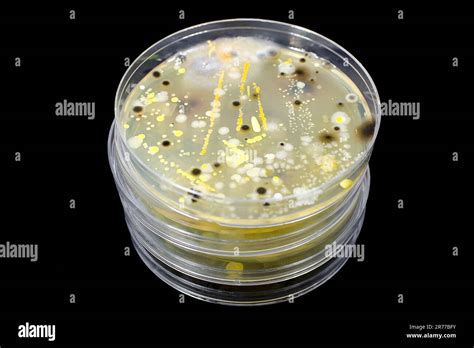 Colonies Of Different Bacteria And Mold Fungi Grown On A Petri Dish