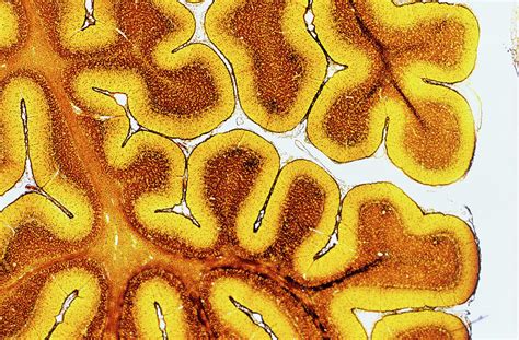 Brain Tissue Photograph By Innerspace Imaging Science Photo Library