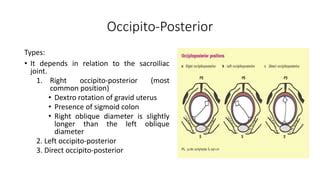 malpresentation malpositionpptx
