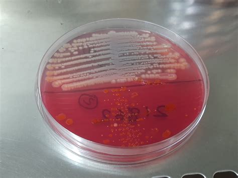 Enterobacter Aerogenes Introduction Morphology Pathogenicity Lab