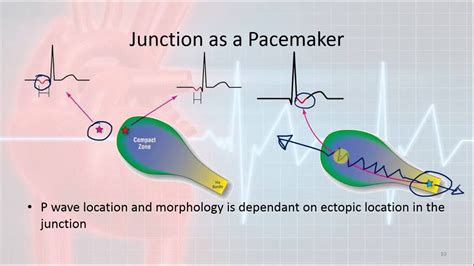 Basic Electrophysiology Part 8 Junctional Rhythms Youtube