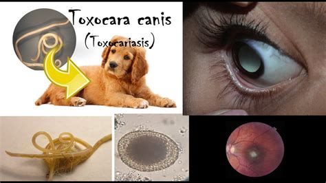 Toxocara Canis