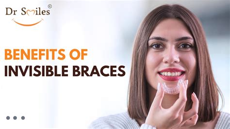 Top 5 Benefits Of Invisible Invisalign Braces Dr Smiles Hyderabad