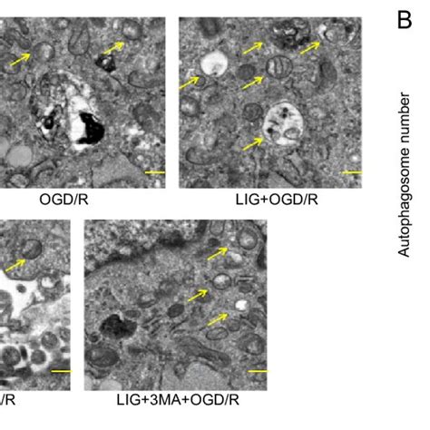 LIG Increases The Formation Of Autophagosomes In OGD R Exposed PC12