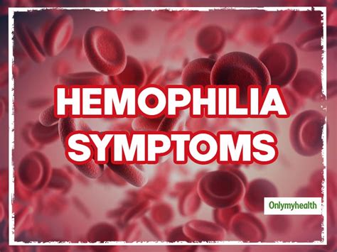 Hemophilia Symptoms: These 3 Conditions Could Be Possible Indicators Of ...