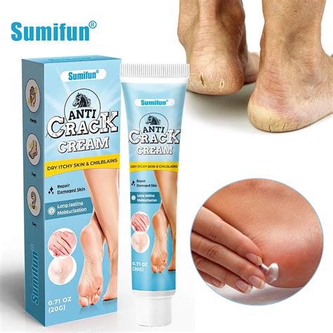 Sumifun, антибликовый медицинский пластырь для удаления омертвевшей ...
