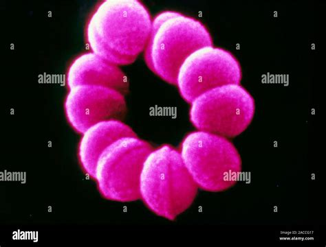 False Color Scanning Electron Micrograph Sem Von Streptococcus Sp