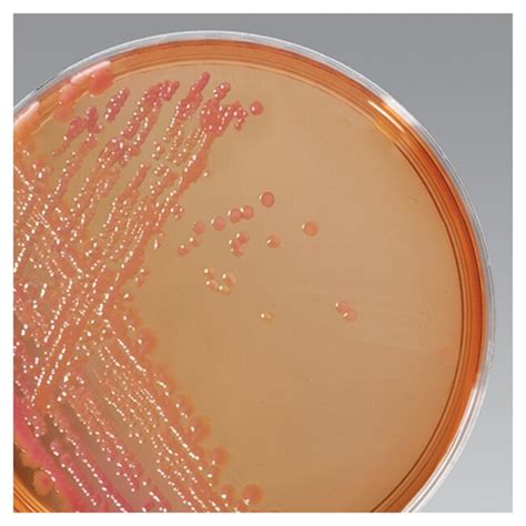 Salmonella Shigella Agar Dehydrated