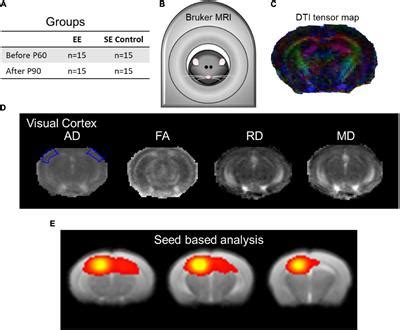 Frontiers Structural And Functional Hippocampal Correlations In