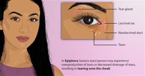 Eye Infection Treatment: What Works and What Doesn't