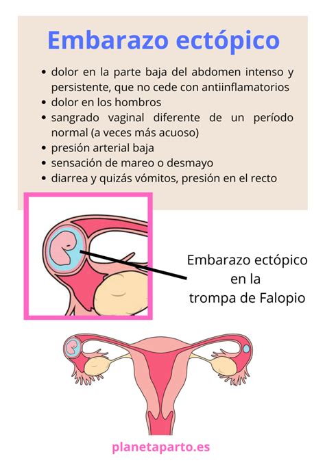 Embarazo Ectópico Tipos Síntomas Causas Y Tratamiento