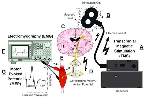 Transcranial Magnetic Stimulation Enhances The Specificity Of Multiple