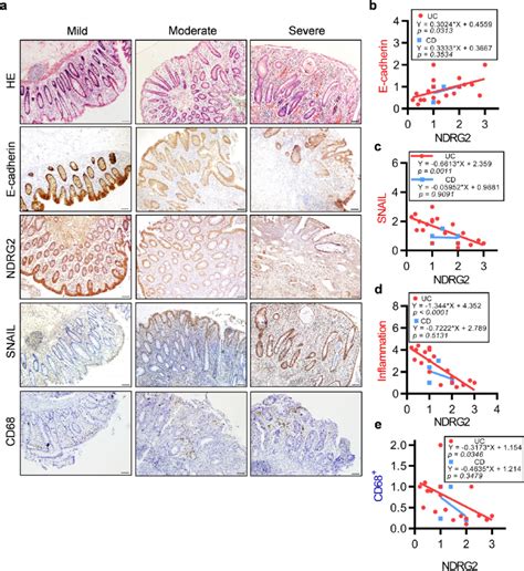 Ndrg2 Positively Correlated With E Cadherin And Negatively Correlated Download Scientific