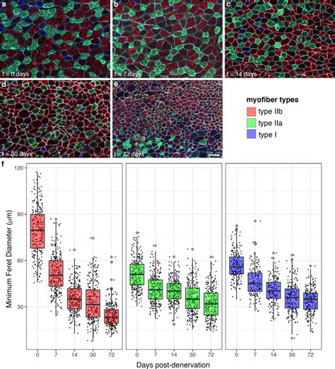 Gastrocnemius Myofiber Morphometry Atrophy Of Type I IIa And IIb